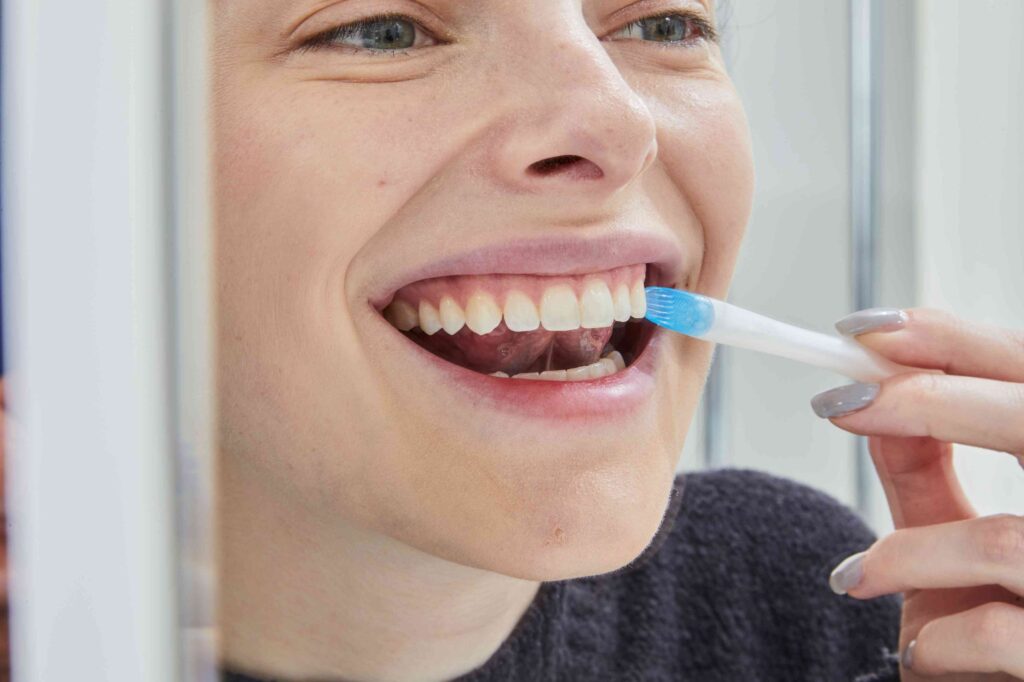 Safe Whitening Solutions Suitable For Individuals With Ongoing Orthodontic Treatments
