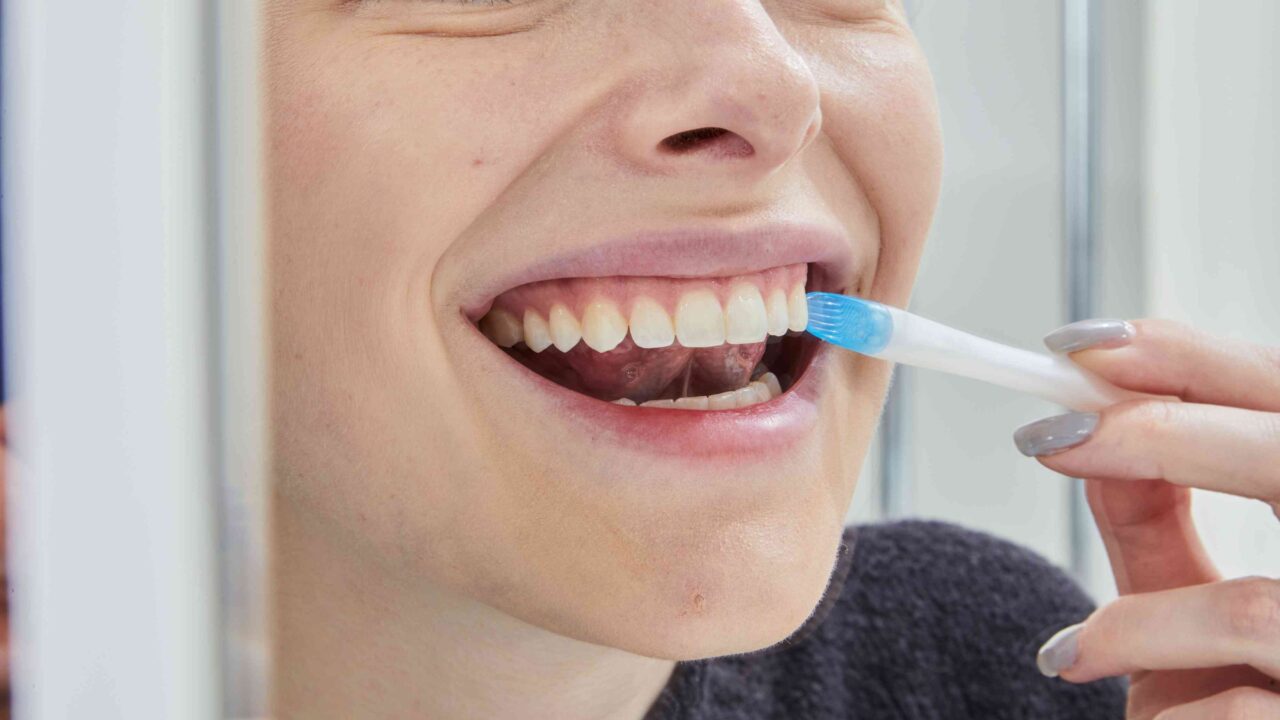 Safe Whitening Solutions Suitable For Individuals With Ongoing Orthodontic Treatments