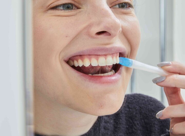 Safe Whitening Solutions Suitable For Individuals With Ongoing Orthodontic Treatments